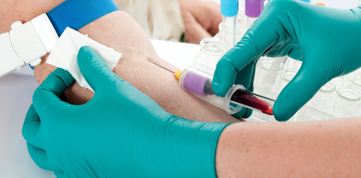 Dit is het verband tussen je cholesterol en je gehoor