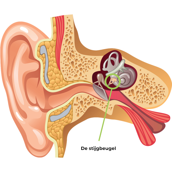 De stijgbeugel - anatomie - Horend Goed