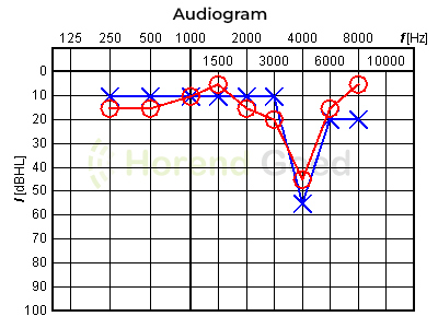 Horend Goed Audiogram