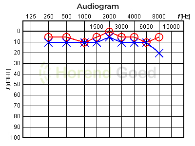 Horend Goed Audiogram
