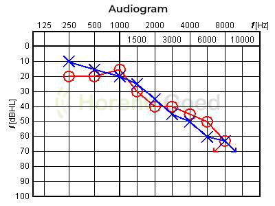 Horend Goed Audiogram