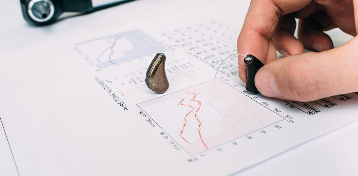 Wat is een audiogram?